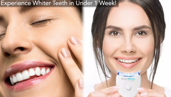 Picture 3 of Bright Whites Complete Teeth Whitening Kit